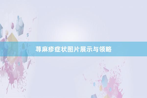 荨麻疹症状图片展示与领略